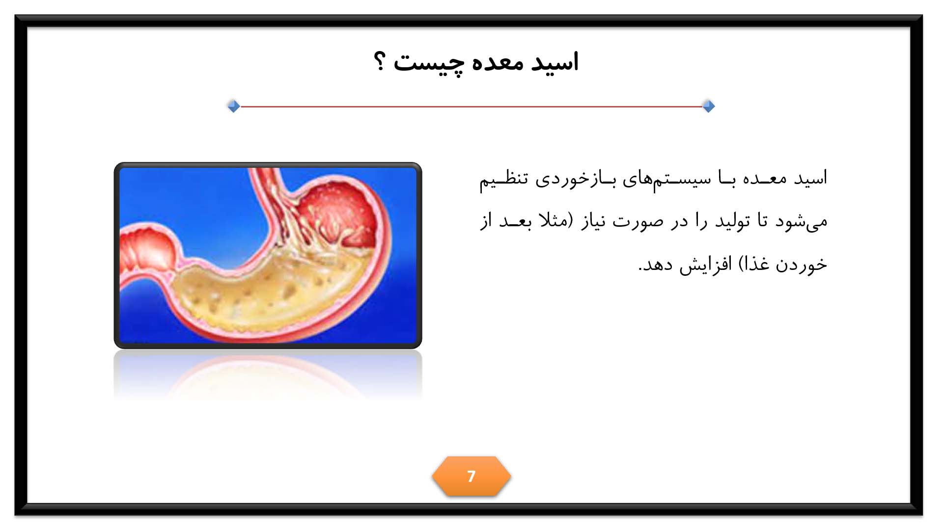 پاورپوینت در مورد اسید معده 